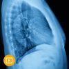 UCSF Thoracic Imaging 2023