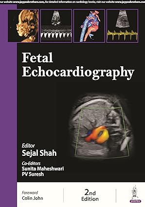 Fetal Echocardiography, 2nd edition (Original PDF from Publisher) Fetal Echocardiography, 2nd edition (Original PDF from Publisher)