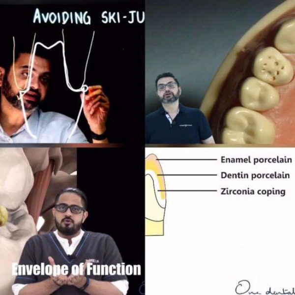 Everyday Fixed Prosthodontics: Certificate Course Everyday Fixed Prosthodontics: Certificate Course