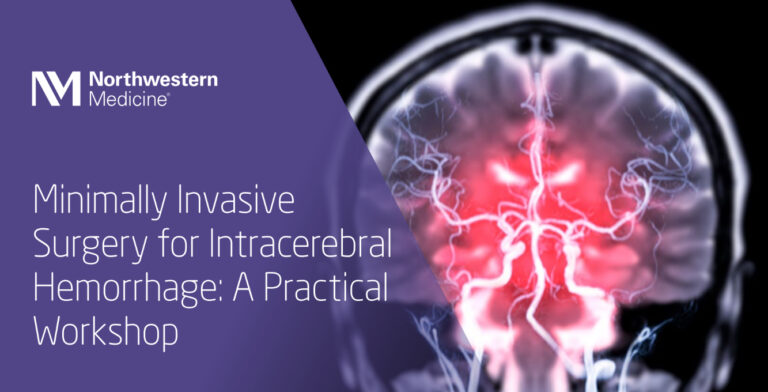 Northwestern Medicine Minimally Invasive Surgery for Intracerebral Hemorrhage A Practical Workshop 2025 Northwestern Medicine Minimally Invasive Surgery for Intracerebral Hemorrhage A Practical Workshop 2025