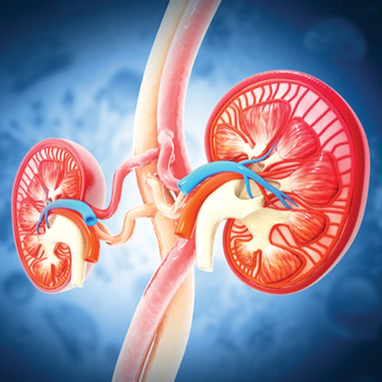 Oakstone Intensive Review of Nephrology 2025 Oakstone Intensive Review of Nephrology 2025
