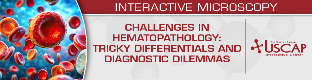 USCAP Challenges in Hematopathology Tricky Differentials and Diagnostic Dilemmas 2025 USCAP Challenges in Hematopathology Tricky Differentials and Diagnostic Dilemmas 2025