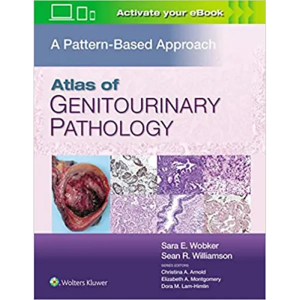 Atlas of Genitourinary Pathology: A Pattern Based Approach (ePub) Atlas of Genitourinary Pathology: A Pattern Based Approach (ePub)