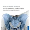 Fractures of the Pelvis and Acetabulum: Principles and Methods of Management, 4th Edition (Original PDF from Publisher) Fractures of the Pelvis and Acetabulum