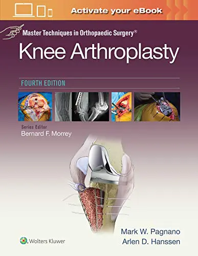 Master Techniques in Orthopedic Surgery: Knee Arthroplasty, 4th Edition (Original PDF from Publisher) Master Techniques in Orthopedic Surgery: Knee Arthroplasty, 4th Edition (Original PDF from Publisher)