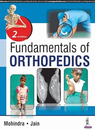 Fundamentals of Orthopedics Fundamentals of Orthopedics