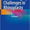 Septal Surgery Challenges in Rhinoplasty (Original PDF from Publisher) Septal Surgery Challenges in Rhinoplasty (Original PDF from Publisher)
