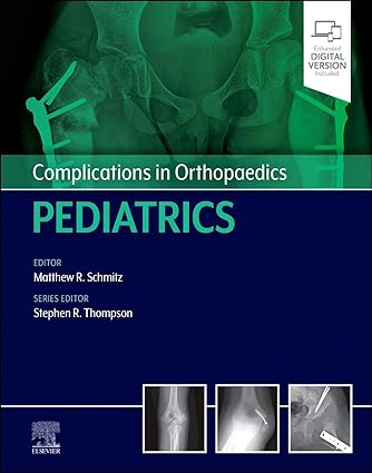 Complications in Orthopaedics: Pediatrics (Original PDF from Publisher) Complications in Orthopaedics: Pediatrics (Original PDF from Publisher)