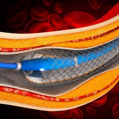 Comprehensive Review and Update of What’s New in Vascular and Endovascular Surgery