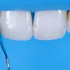OHI-S Aesthetic Dentistry Congress in Milan Difficult cases in esthetic dentistry OHI-S Aesthetic Dentistry Congress in Milan Difficult cases in esthetic dentistry