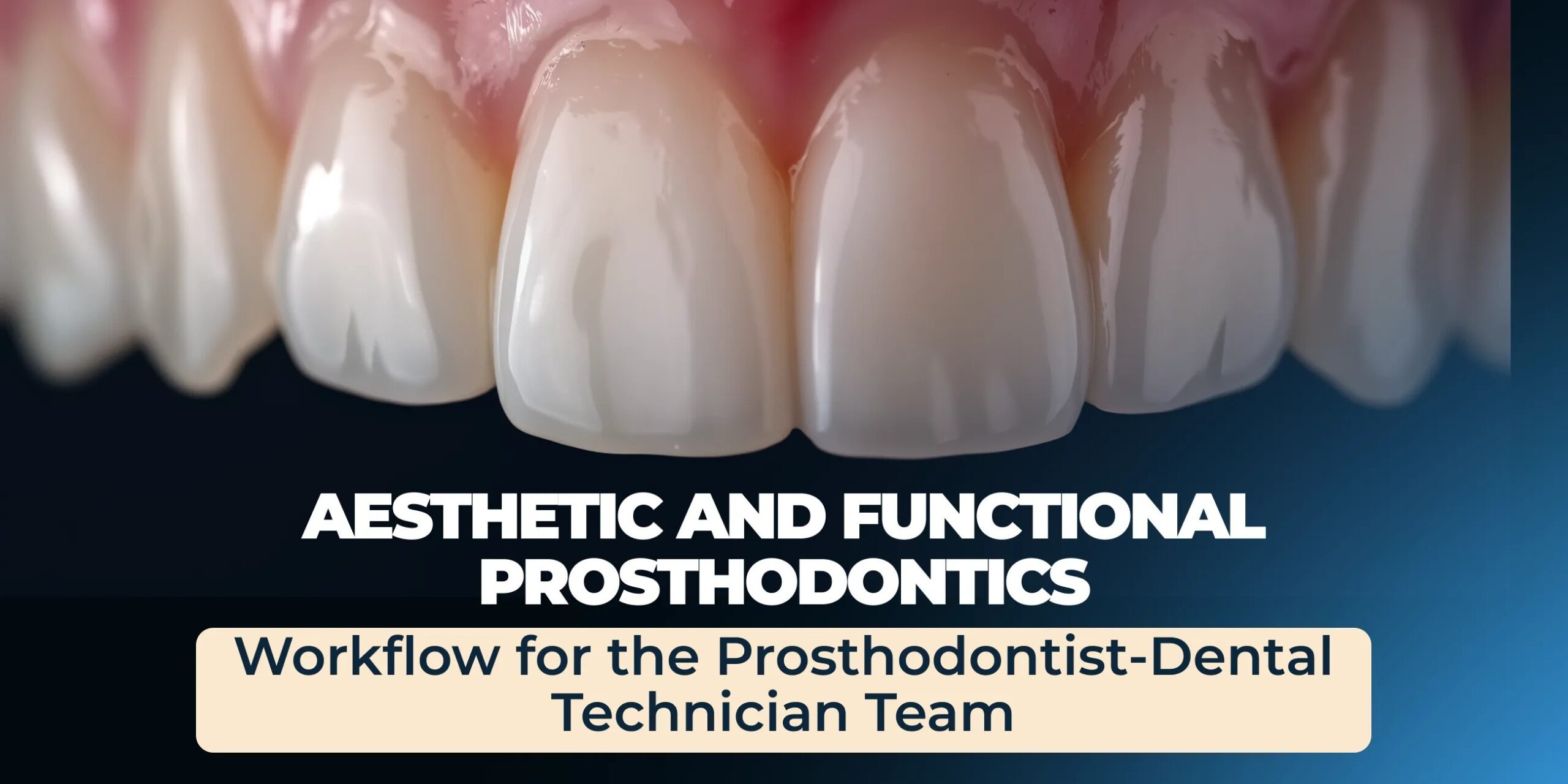 OHI-S Aesthetic and Functional Prosthodontics. Workflow for the Prosthodontist-Dental Technician Team OHI-S Aesthetic and Functional Prosthodontics. Workflow for the Prosthodontist-Dental Technician Team