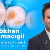 OHI-S Art and science of class 2 composite restorations OHI-S Art and science of class 2 composite restorations
