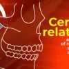 OHI-S Centric relation all methods of registration and clinical application