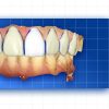 OHI-S Complete prosthetic protocols CADCAM CEREC OHI-S Complete prosthetic protocols CADCAM CEREC