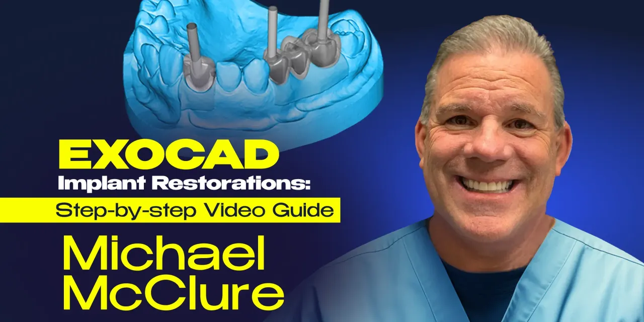 OHI-S EXOCAD Implant Restorations – Step-by-step Video Guide 2023 OHI-S EXOCAD Implant Restorations Step-by-step Video Guide