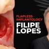 OHI-S Flapless implantology protocols for immediate implant placement and loading OHI-S Flapless implantology protocols for immediate implant placement and loading