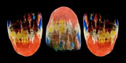 OHI-S Fundamental principles of aesthetics in dentistry dental, gingual and facial aesthetics 2021