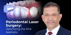 OHI-S Laser Periodontology Optimizing the Pink Aesthetic