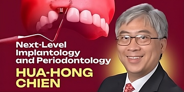 OHI-S Next-Level Implantology and Periodontology Mastering Immediate Implantation, Peri-implant Soft Tissue Augmentation, Sinus Lifting OHI-S Next-Level Implantology and Periodontology Mastering Immediate Implantation, Peri-implant Soft Tissue Augmentation, Sinus Lifting