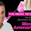 OHI-S The Index Technique. No-prep worn dentition treatment OHI-S The Index Technique. No-prep worn dentition treatment