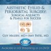 QMP Aesthetic Eyelid and Periorbital Surgery Surgical Adjuncts and Pearls for Success 2018 QMP Aesthetic Eyelid and Periorbital Surgery Surgical Adjuncts and Pearls for Success 2018