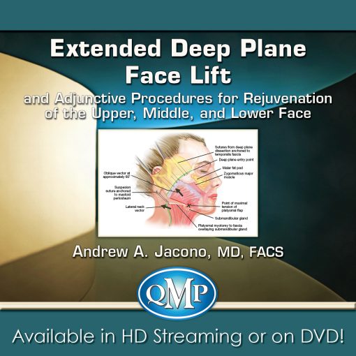 QMP Extended Deep Plane Face Lift and Adjunctive Procedures for Rejuvenation of the Upper, Middle, and Lower Face 2018 QMP Extended Deep Plane Face Lift and Adjunctive Procedures for Rejuvenation of the Upper, Middle, and Lower Face 2018