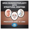 QMP Open Rhinoseptoplasty With Structural Grafting 2017 QMP Open Rhinoseptoplasty With Structural Grafting 2017