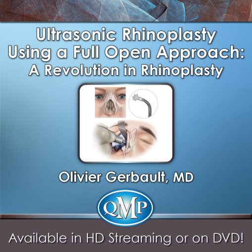 QMP Ultrasonic Rhinoplasty Using a Full Open Approach A Revolution in Rhinoplasty 2018 QMP Ultrasonic Rhinoplasty Using a Full Open Approach A Revolution in Rhinoplasty 2018
