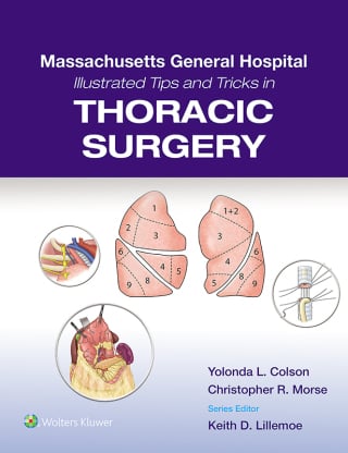 Massachusetts General Hospital Illustrated Tips and Tricks in Thoracic Surgery (EPUB and pdf) MGH Illustrated Tips and Tricks in Thoracic Surgery (EPUB)
