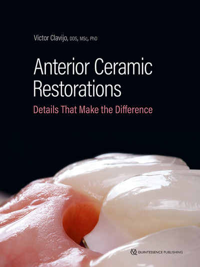 Anterior Ceramic Restorations: Details That Make the Difference (EPUB and pdf) Anterior Ceramic Restorations: Details That Make the Difference (Epub)