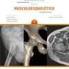 Coleção CBR Volume 7 – Musculoesquelético (Portuguese Edition) (EPUB)