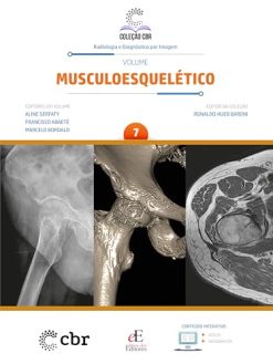 Coleção CBR Volume 7 – Musculoesquelético (Portuguese Edition) (EPUB)
