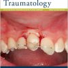 Dental Traumatology: Full Journal Archive (2010 – 2025) Dental Traumatology: Full Journal Archive (2010 – 2025)