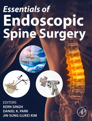Essentials of Endoscopic Spine Surgery (Original PDF from Publisher) Essentials of Endoscopic Spine Surgery (Original PDF from Publisher)