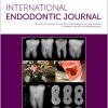 International Endodontic Journal, Full Archive (2008 – 2025) International Endodontic Journal, Full Archive (2008 – 2025)