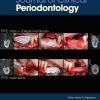 Journal of Clinical Periodontology, Full Archive (2005-2025) Journal of Clinical Periodontology, Full Archive (2005-2025)