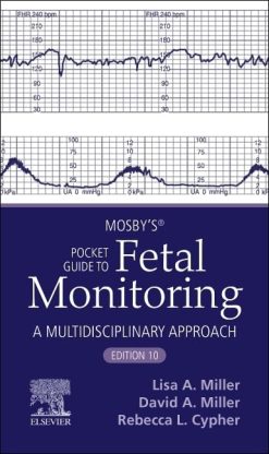 Mosby’s® Pocket Guide to Fetal Monitoring (Nursing Pocket Guides), 10th edition (EPUB)