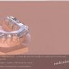 OHI-S The occlusal Plane System – predictable approach when dealing with complex and functional cases in everyday practice