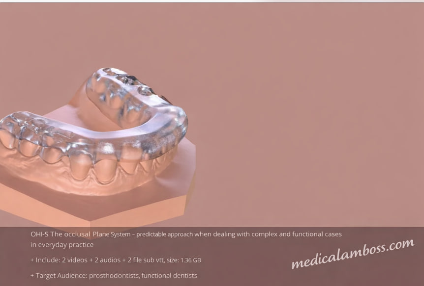 OHI-S The occlusal Plane System – predictable approach when dealing with complex and functional cases in everyday practice OHI-S The occlusal Plane System – predictable approach when dealing with complex and functional cases in everyday practice