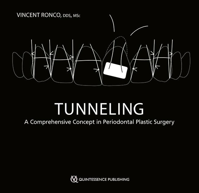 Tunneling A Comprehensive Concept in Periodontal Plastic Surgery Tunneling A Comprehensive Concept in Periodontal Plastic Surgery