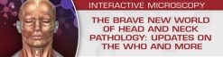 USCAP The Brave New World of Head and Neck Pathology: Updates on the WHO and More 2018