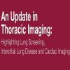 Updates in Thoracic Imaging Highlighting Lung Screening, Interstitial Lung Disease, and Cardiac Imaging 2020 Updates in Thoracic Imaging Highlighting Lung Screening, Interstitial Lung Disease, and Cardiac Imaging 2020