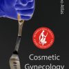 ISCG Video Atlas of Cosmetic Gynecology ISCG Video Atlas of Cosmetic Gynecology