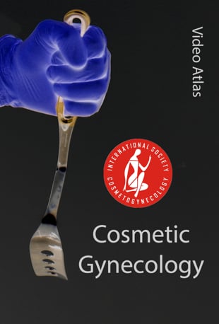 ISCG Video Atlas of Cosmetic Gynecology ISCG Video Atlas of Cosmetic Gynecology