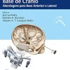 Práticas em Cirurgia da Base de Crânio: Abordagens para Base Anterior e Lateral (Portuguese Edition) (AZW3 + EPUB + Converted PDF)