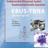 Endobronchial Ultrasound-Guided Transbronchial Needle Aspiration (EBUS-TBNA): A Practical Approach 1st Edition