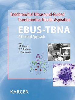 Endobronchial Ultrasound-Guided Transbronchial Needle Aspiration (EBUS-TBNA): A Practical Approach 1st Edition