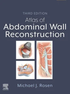 Atlas of Abdominal Wall Reconstruction, 3rd Edition (Original PDF from Publisher)