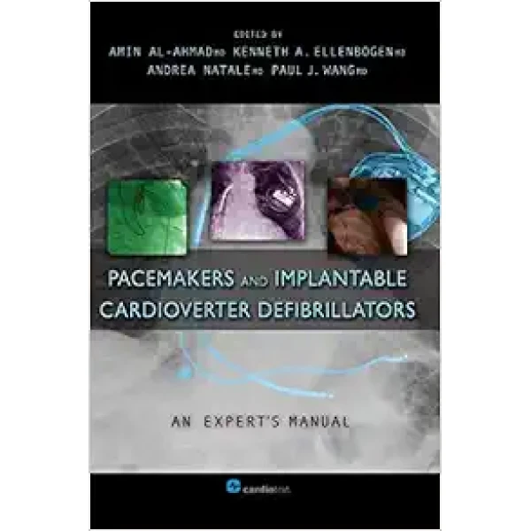 Pacemakers And Implantable Cardioverter Defibrillators: An Expert’s Manual (Original PDF From Publisher) Pacemakers And Implantable Cardioverter Defibrillators: An Expert’s Manual (Original PDF From Publisher)