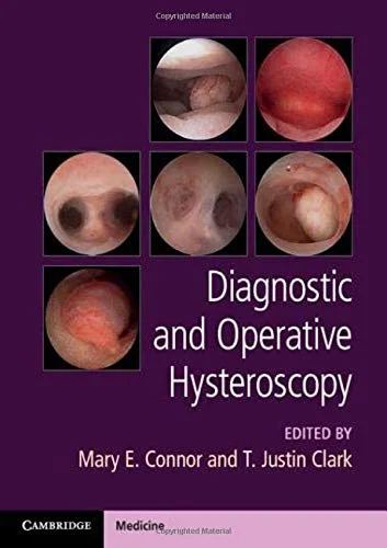 Diagnostic and Operative Hysteroscopy (ePub+Converted PDF) Diagnostic and Operative Hysteroscopy (ePub+Converted PDF)